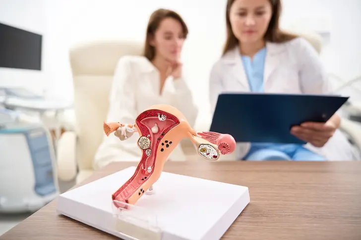 Uterine Cancer Stages