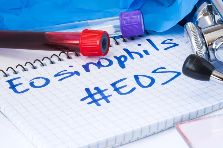 Treating Eosinophilic Asthma Treating Eosinophilic Asthma