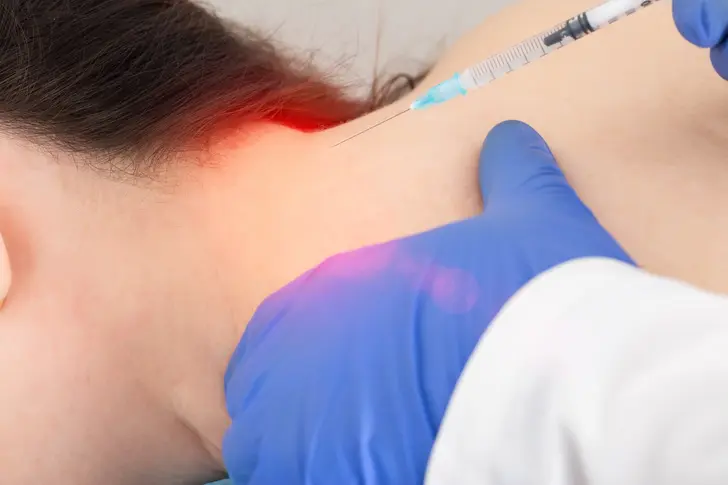 What Is an Occipital Nerve Block?