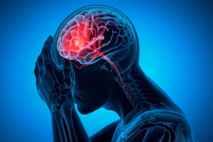 What Are High-Frequency Episodic Migraines? What Are High-Frequency Episodic Migraines?