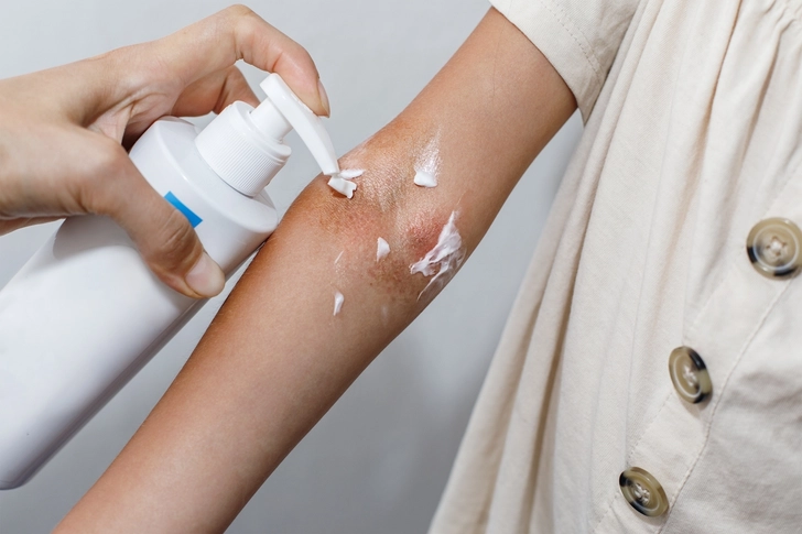 Adjusting Topical Treatments Adjusting Topical Treatments