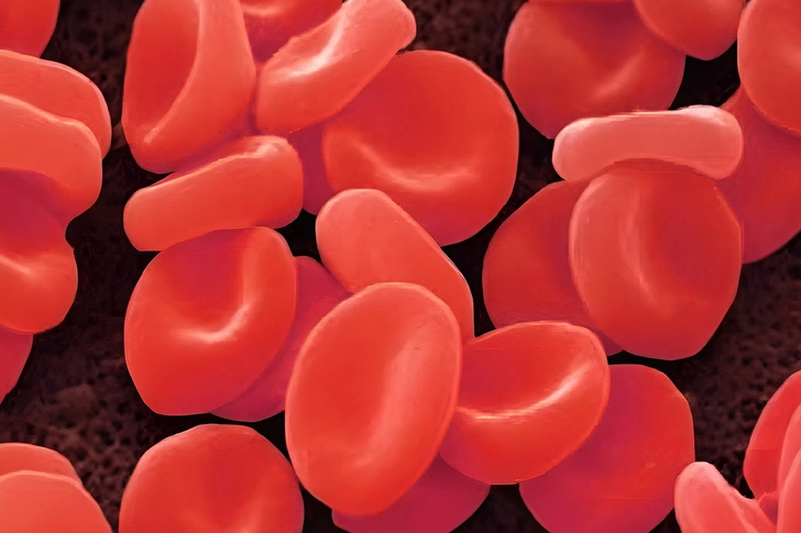 Anemia