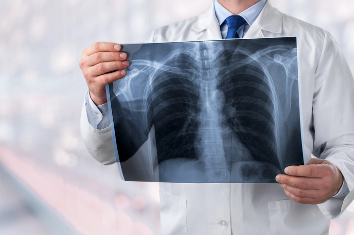 Types of Recurrence Types of Recurrence