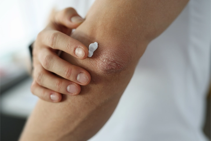 All-Over Pain Relief