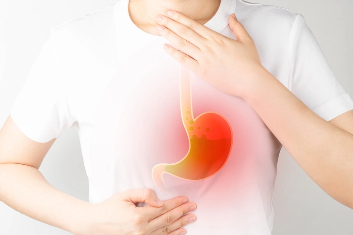 How Heartburn Triggers Asthma
