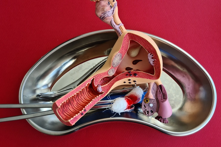 Surgical Options Surgical Options