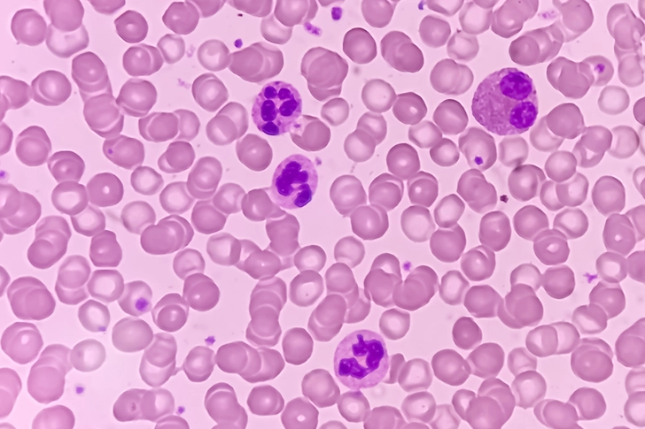 What Are Eosinophils?