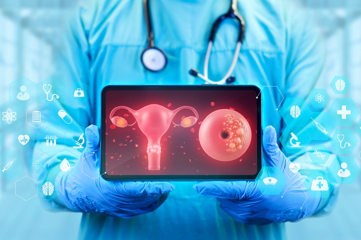 How Do Doctors Determine the Cancer Stage?