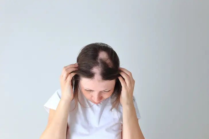 Understanding Hair Loss Understanding Hair Loss