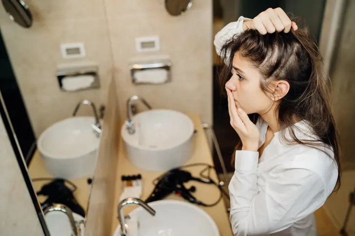 Understanding Alopecia Areata