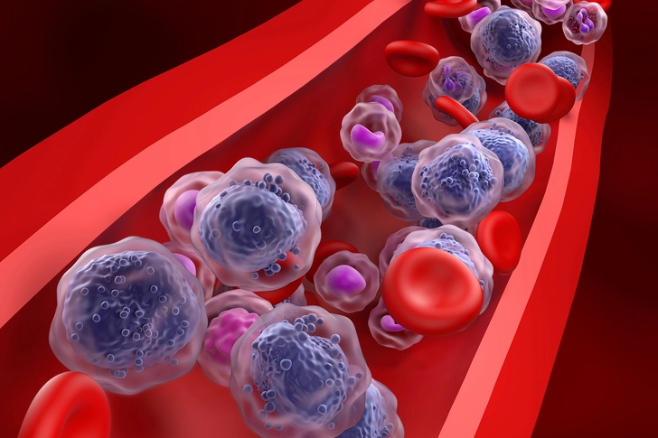 Cancer Starts in Your Bone Marrow