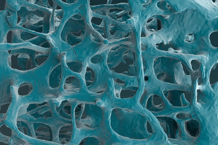 Bones Become Soft and Break Easily