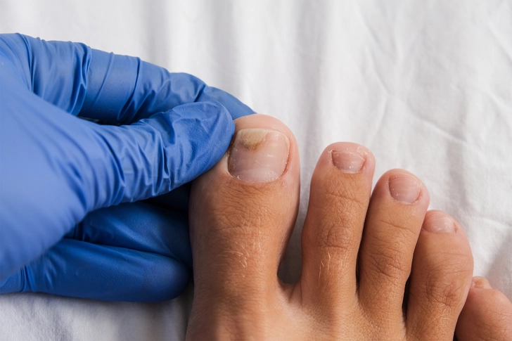 How Will Your Nails Look? How Will Your Nails Look?