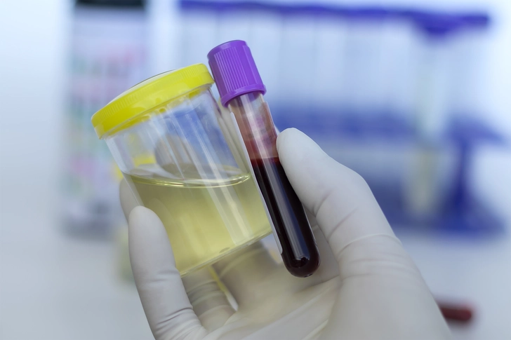 How Is SMM Diagnosed? How Is SMM Diagnosed?