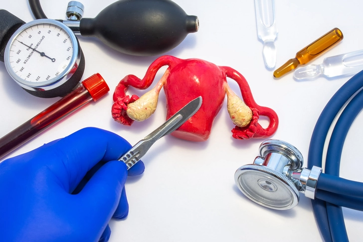 Stage I: Confined to the Uterus