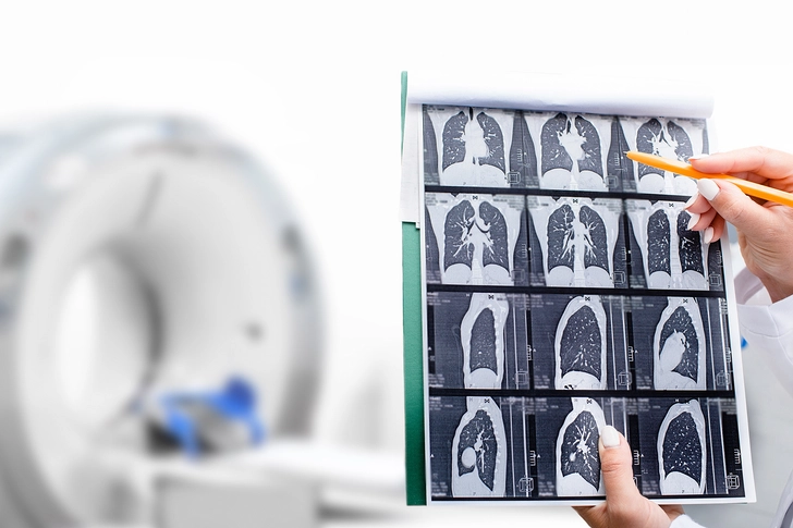 Understanding Scan Results Understanding Scan Results
