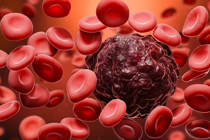 Fighting Cancer with Antioxidants Fighting Cancer with Antioxidants