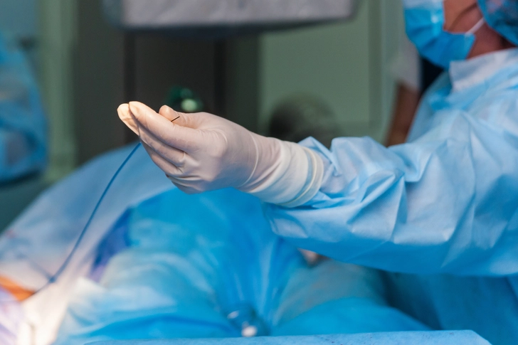 Types of Lobectomy Procedures
