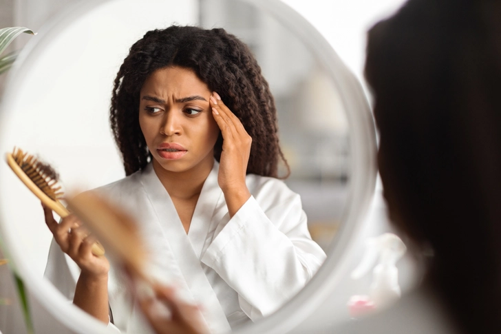 Telogen Effluvium Explained