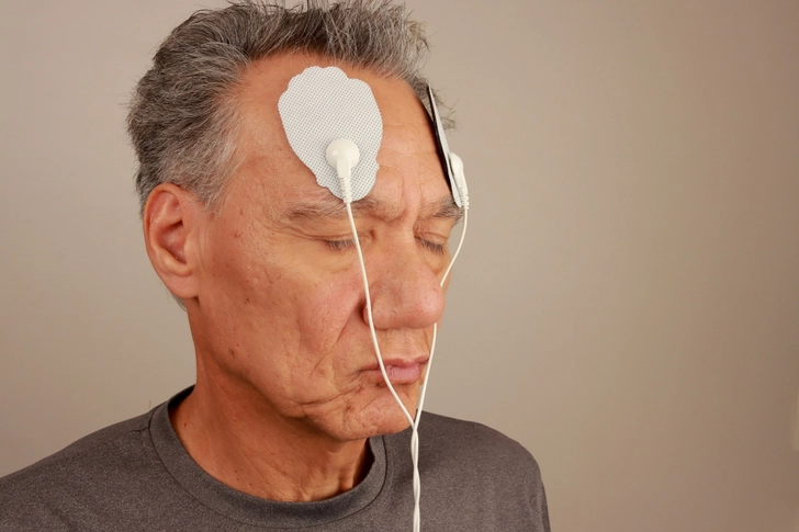 Transcutaneous Supraorbital Nerve Stimulation