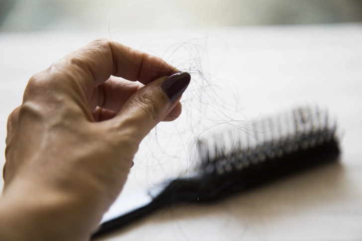 Common Causes of Hair Loss