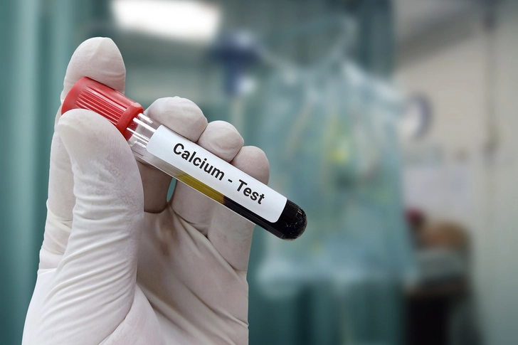 Watch for High Calcium Levels