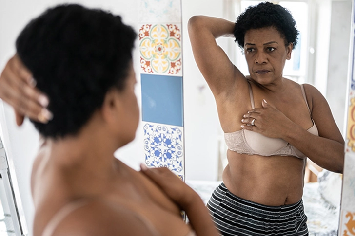 Breast or Nipple Changes Breast or Nipple Changes