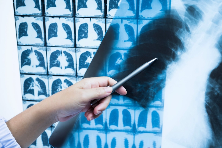 Diagnosis Diagnosis