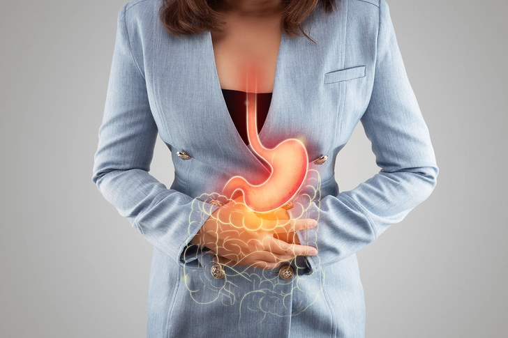 GERD in Patients With Asthma