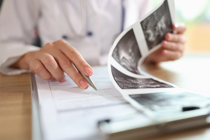 Staging and Prognosis