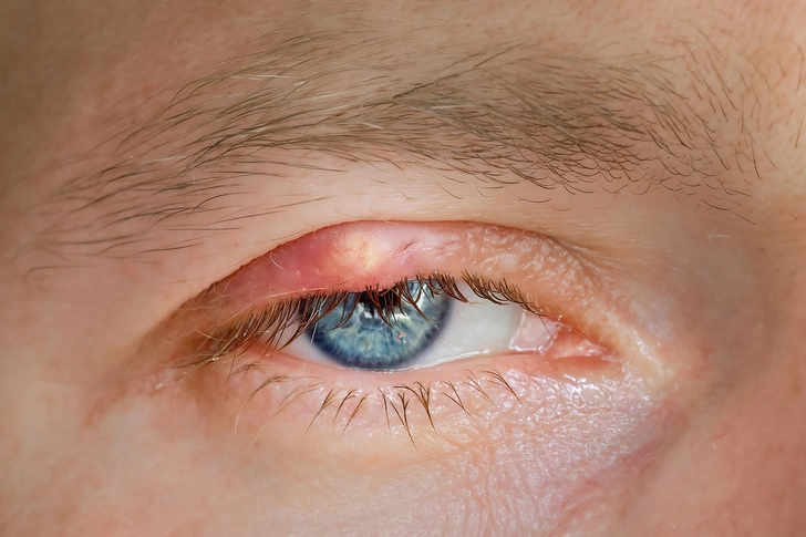 Where Swelling Occurs