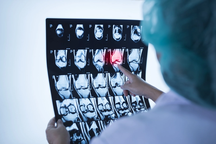 How Are They Diagnosed?