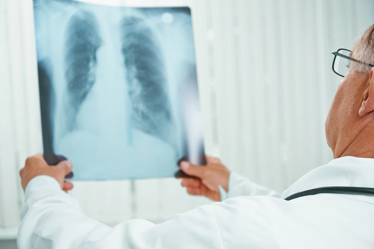 Complications of RSV