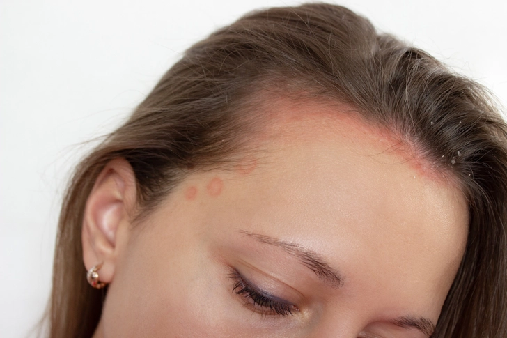 Medical Conditions Affecting Hair Growth