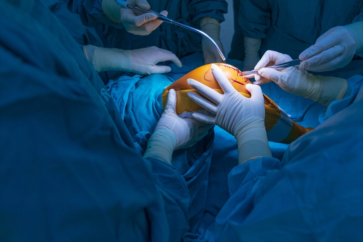 Surgical Options Surgical Options