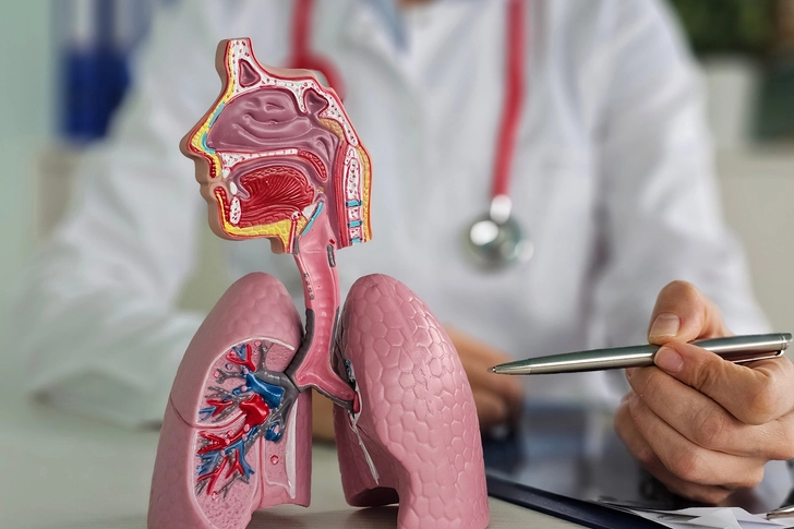 Bronchial Thermoplasty Bronchial Thermoplasty