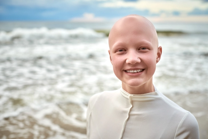 Alopecia Universalis
