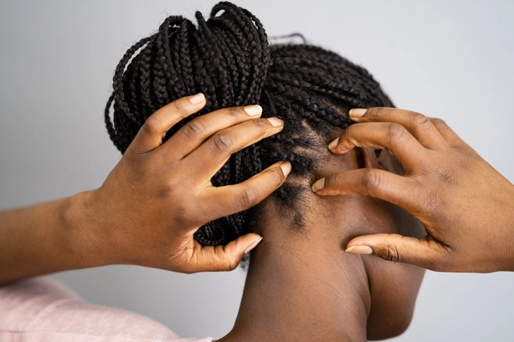 More Tips for Scalp Care