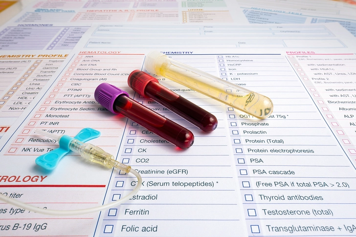 How Doctors Diagnose HAE