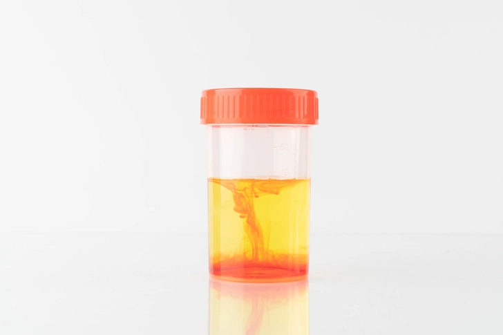 Thrombocytopenia Symptoms