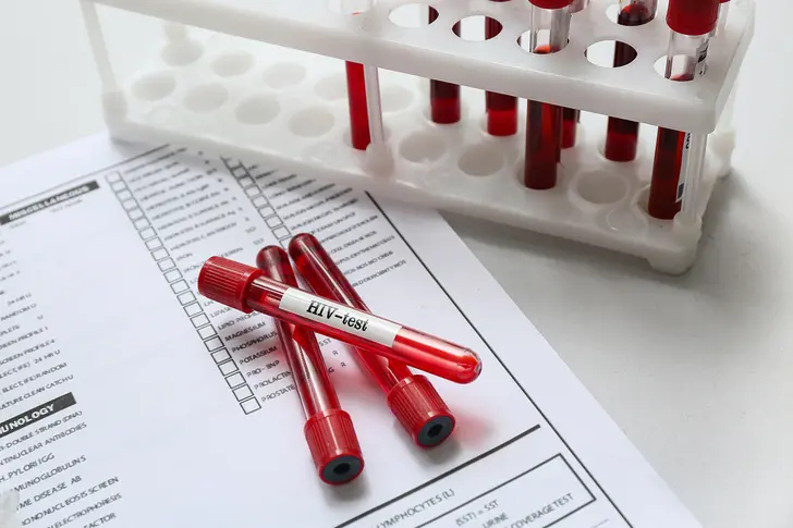 Understanding HIV Viral Load