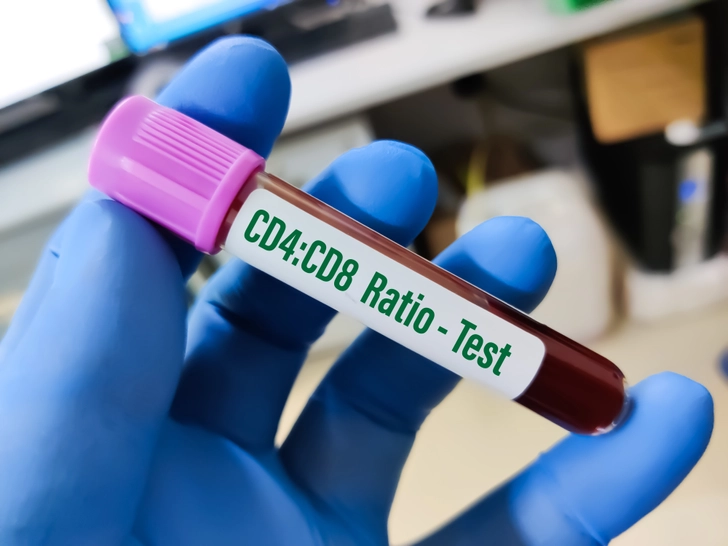 The Role of CD4 and CD8 Cells The Role of CD4 and CD8 Cells