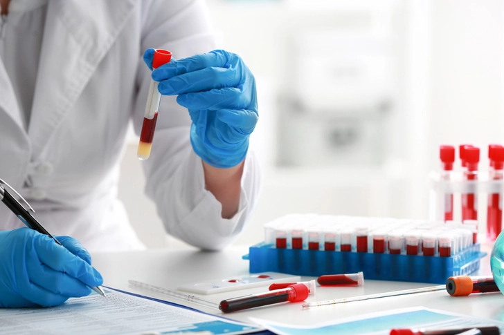 Interpreting Your CD4:CD8 Ratio Test Results Interpreting Your CD4:CD8 Ratio Test Results
