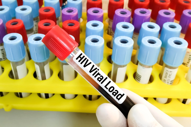 Viral Load and CD4 Count Connection Viral Load and CD4 Count Connection