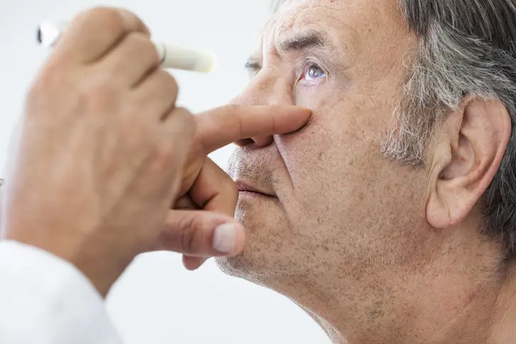 Understanding Macular Degeneration Understanding Macular Degeneration