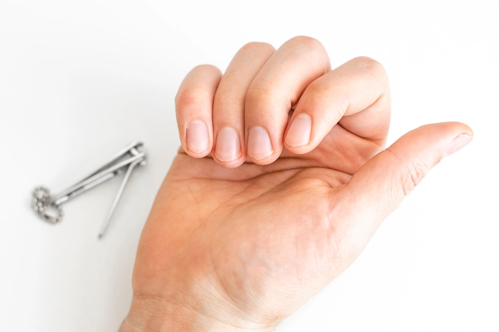 Preventing Nail Psoriasis 