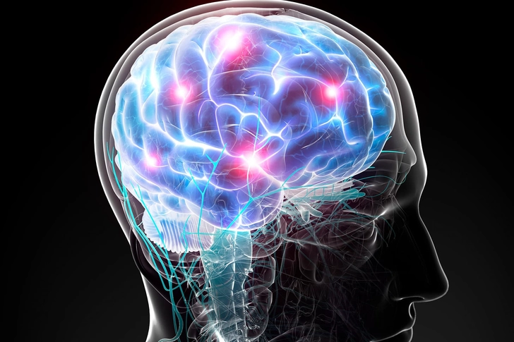 Transcranial Direct Current Stimulation (tDCS)