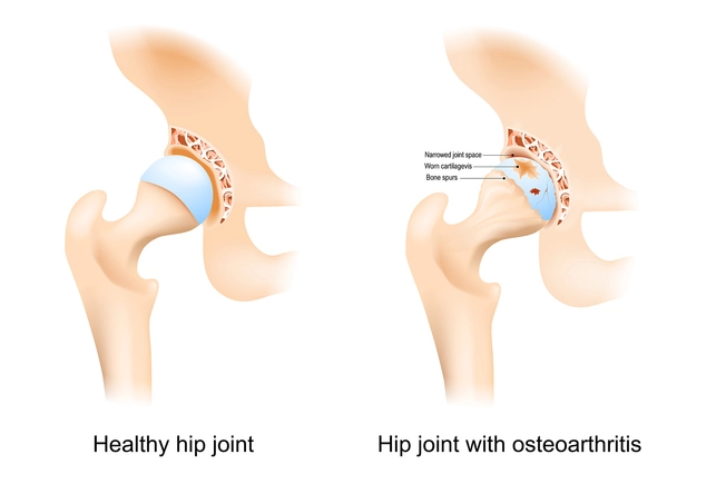 Better Joint Function