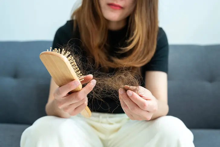 Psoriasis Hair Loss