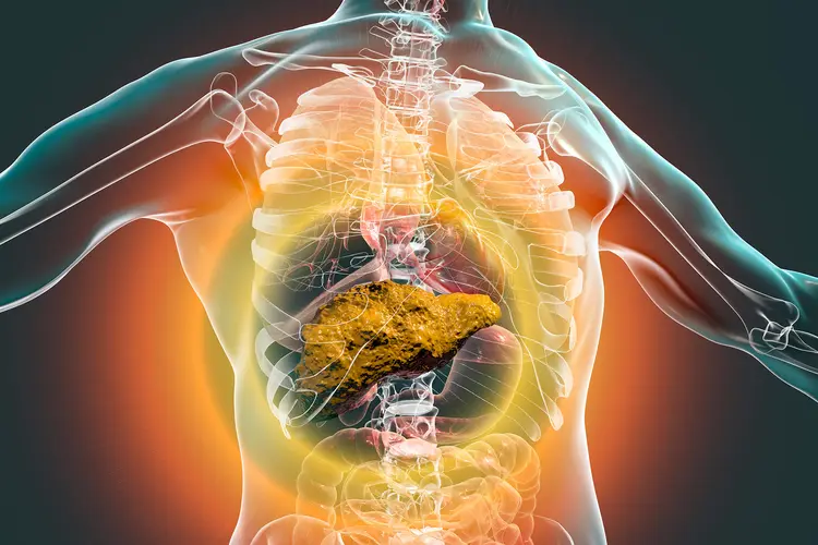 photo of damaged liver
